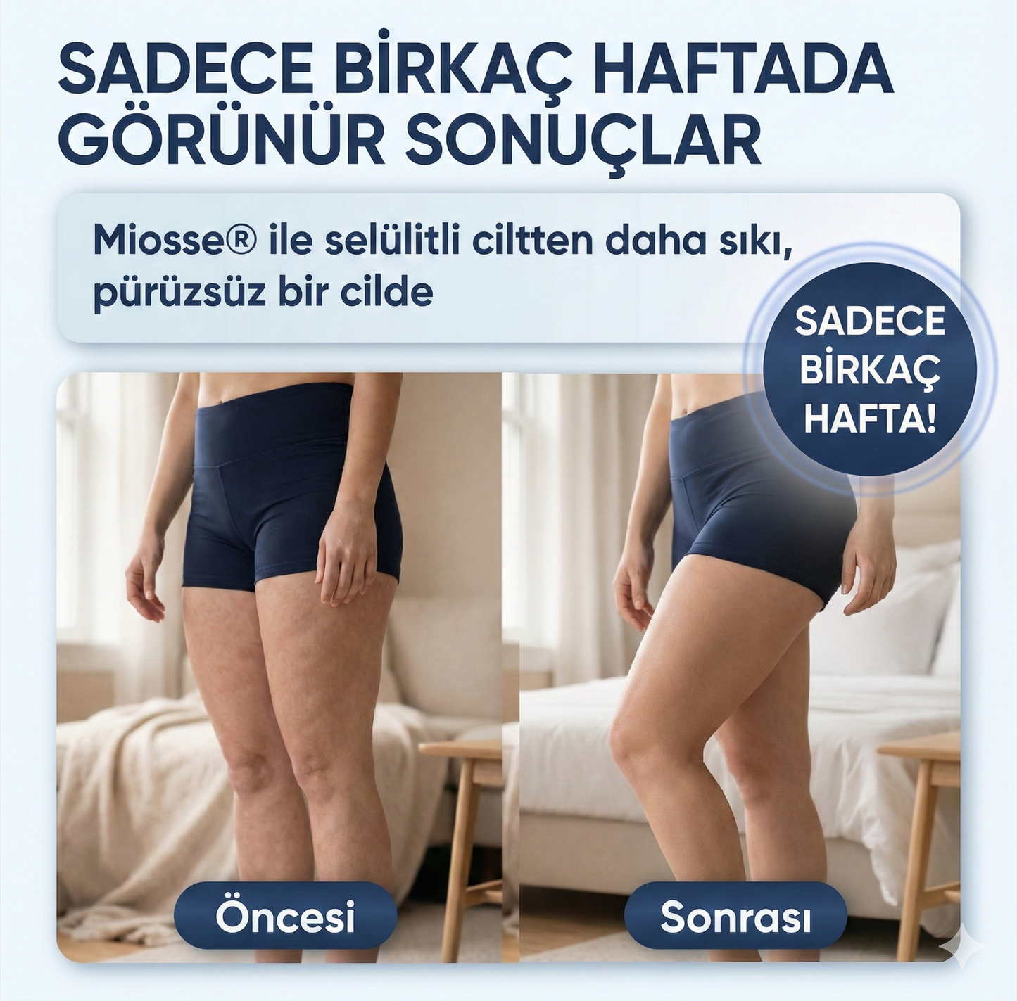 Miosse® Selülit Giderici (Daha Sıkı Bir Cilt)